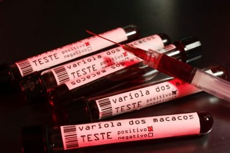 imagem de tubos de ensaio sinalizando resultado positivo para varíola dos macacos