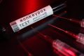 Monkeypox: Fiocruz isola vírus e produz imagens detalhadas. Veja