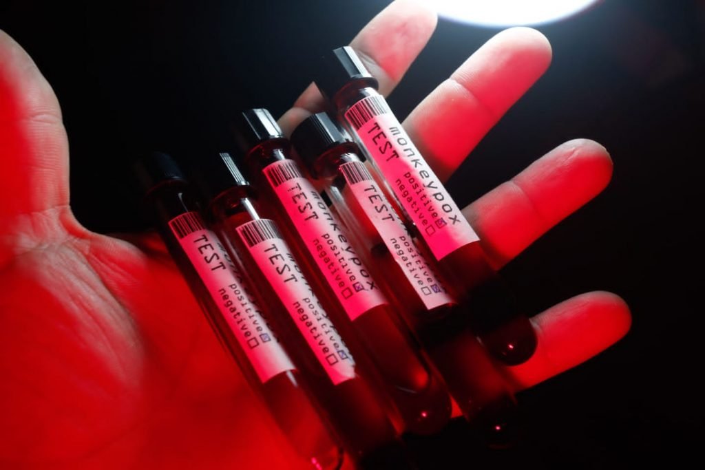 Picture of test tubes indicating a positive result for monkeypox