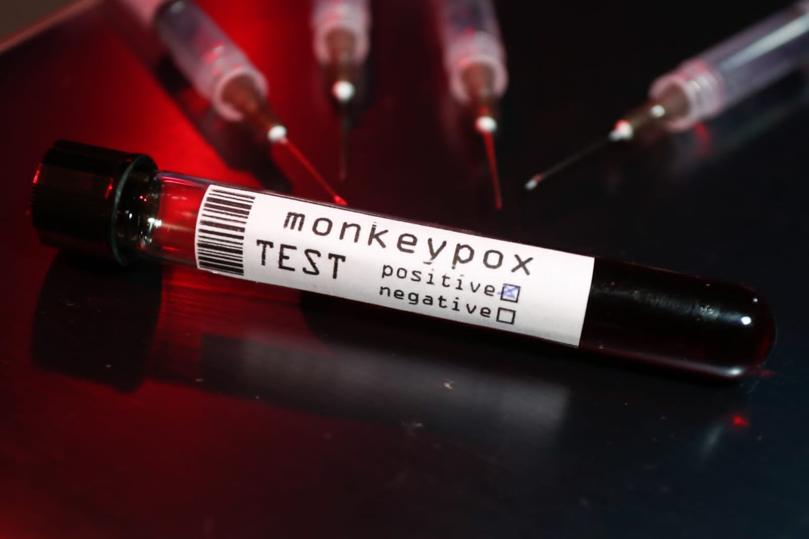 imagem de tubos de ensaio sinalizando resultado positivo para varíola dos macacos - Metrópoles