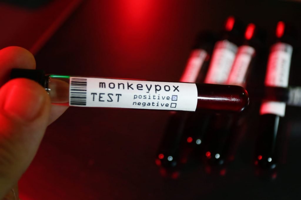 Picture of test tubes indicating a positive result for monkeypox