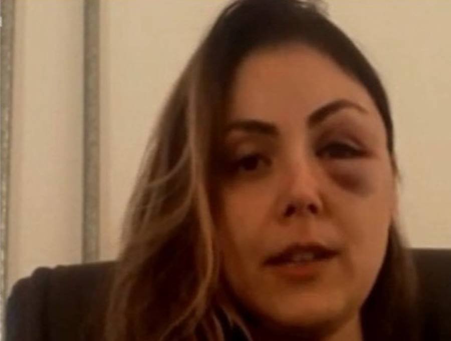 A procuradora-geral Gabriela Samadello Monteiro de Barros, de 39 anos, começou a ser agredida inicialmente com socos e uma cotovelada no rosto pelo também procurador Demétrius Oliveira Macedo, de 34 anos