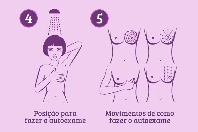 Preventive exam step by step illustration - Metropolises