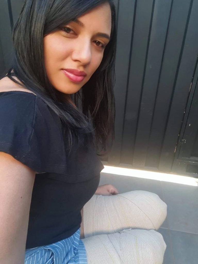 Mulher sentada com as duas pernas amputadas