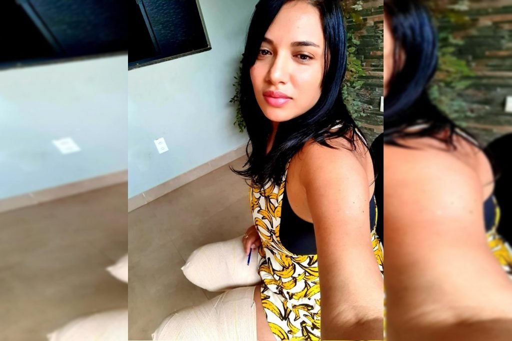 Mulher sentada com as duas pernas amputadas