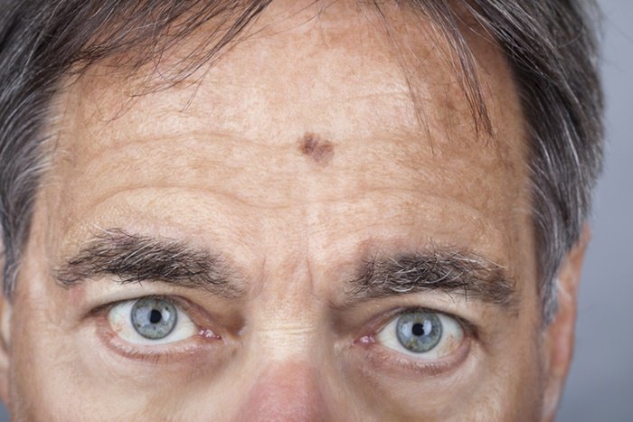 Upper part of a male face.  The eyes are blue, the hair is gray and the skin is wrinkled- Metropolises