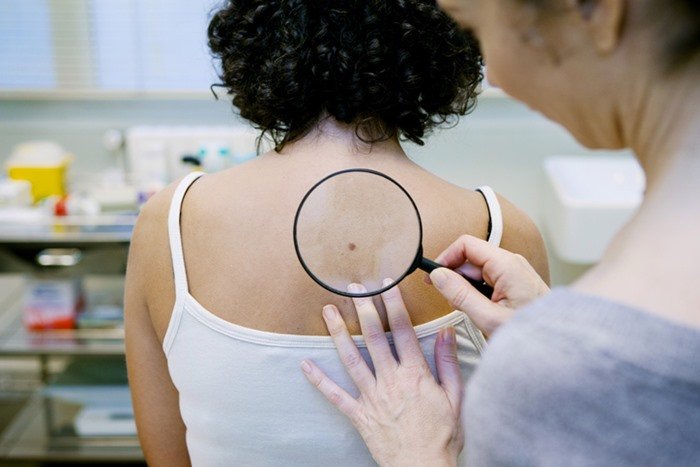 A doctor examining a patient's skin