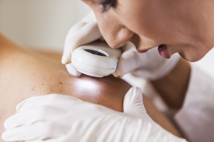 Doctor investigating patient's skin