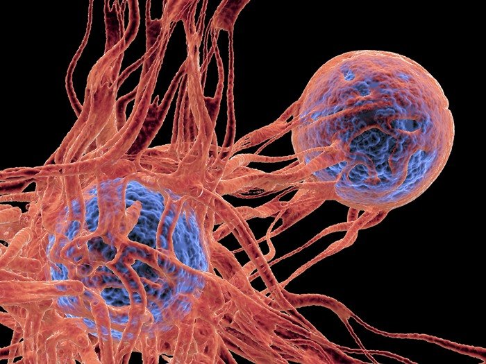 Illustration of cancer cells - metropolis