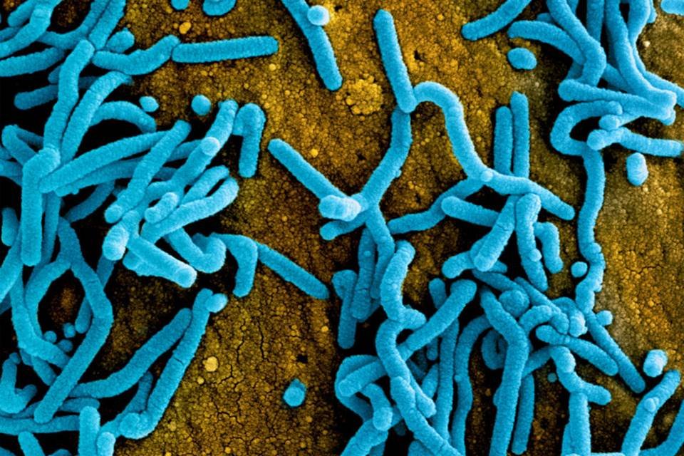OMS confirma 2 mortes em Gana por Marburg, vírus da família do Ebola |  Metrópoles