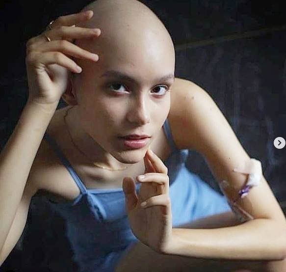 Modelo Samantha Natasha morre, aos 18 anos, vítima de câncer no DF - Metrópoles