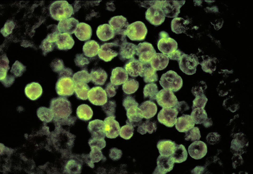 imagem microscópica de ameba
