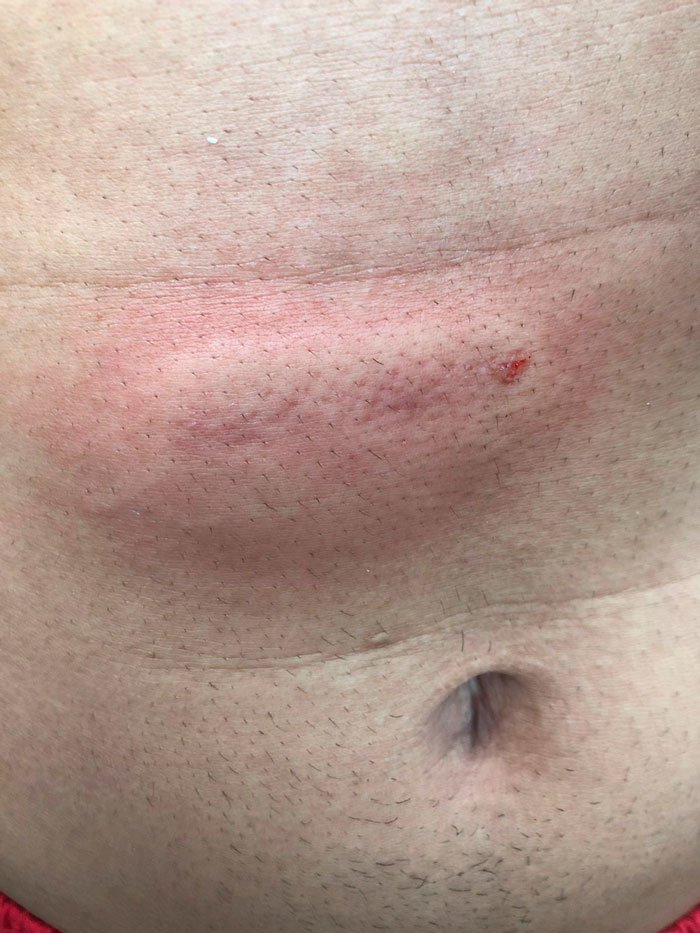 Homem é atingido por bala perdida no RJ