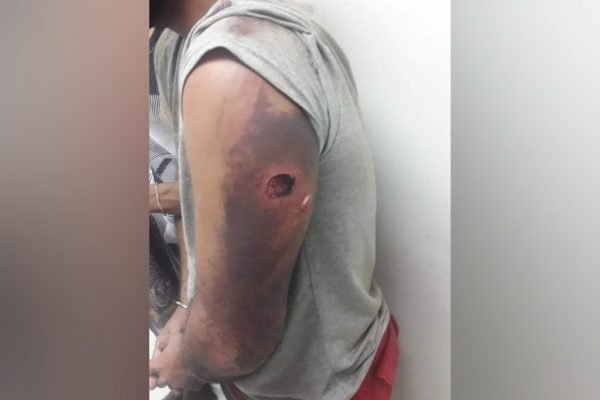 Homem detido pelo Exército em 2018 no Rio de Janeiro relata tortura