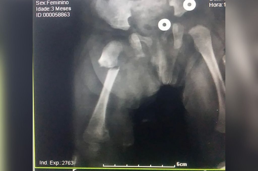 Casal é preso acusado pela morte da filha de 3 meses no RJ 2