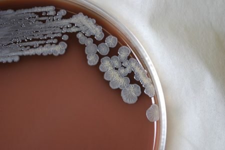 Colônia de basctérias crescendo em placa de Petri - Metrópoles