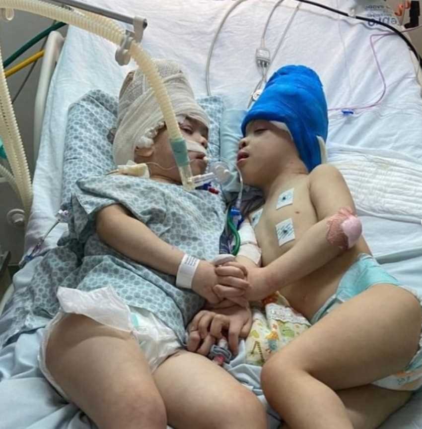 foto colorida de gêmeos hospitalizados