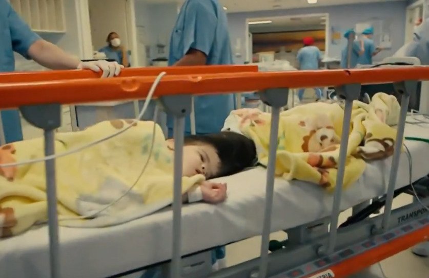 foto colorida de gêmeos siameses em maca hospitalar