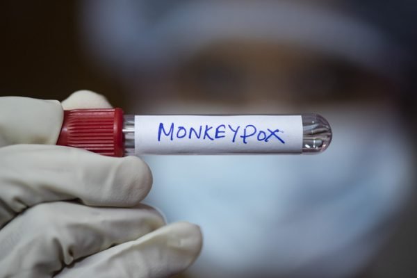 Pessoa segurando fraco com adesivo com a palavra Monkeypox- Metrópoles