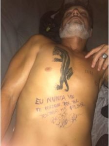 homem dormindo com anotação a caneta na barriga
