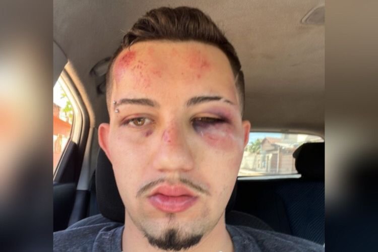 Jovem agredido Paineiras Minas Gerais PM (2)