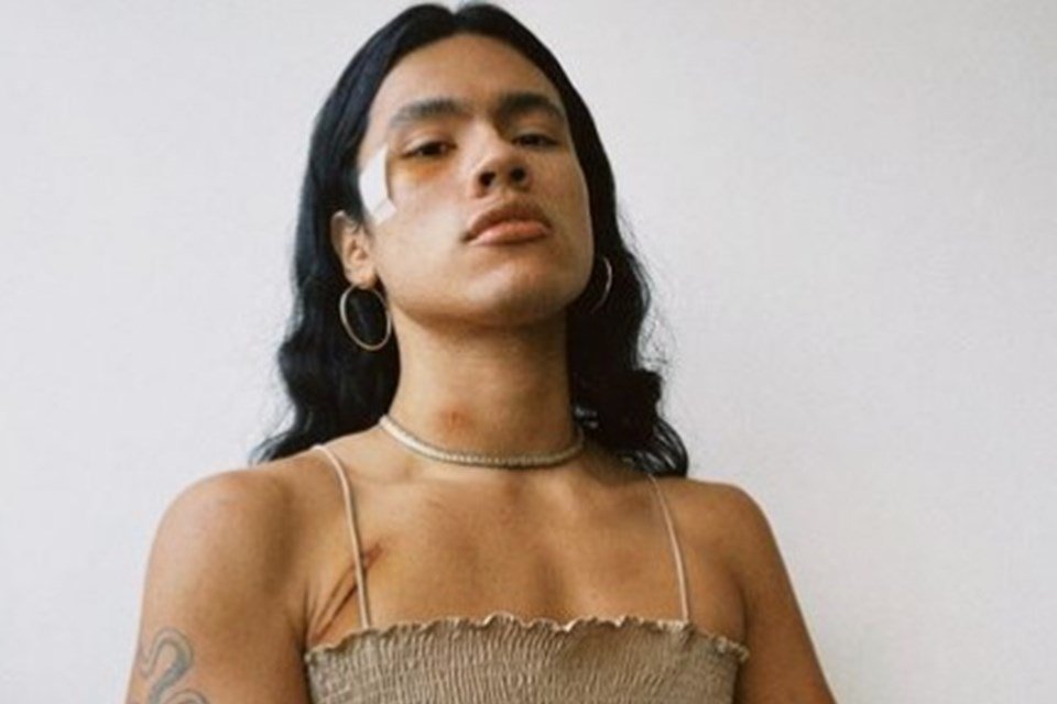 Espancada e vítima de transfobia: modelo faz forte relato nas redes - Metrópoles