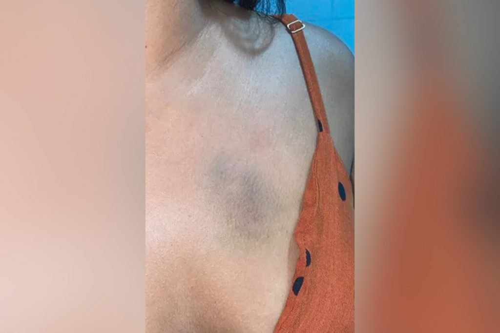 Mulher denuncia ex-companheiro por sequestro, agressão, cárcere e estupro no Rio