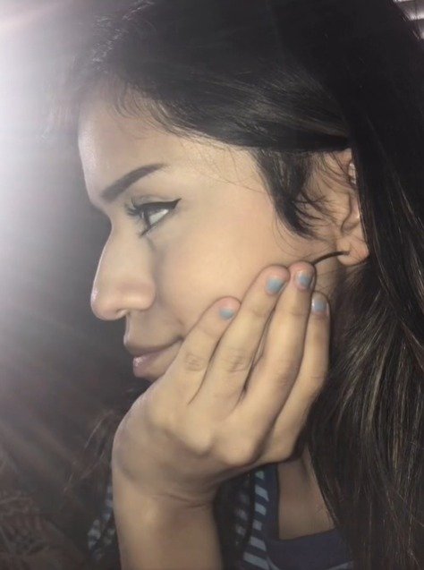 Revanche! Após ser traída, mulher faz ex pagar sua cirurgia plástica