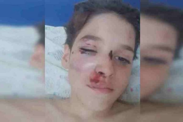 Vergonha No Rosto De Um Jovem Que Se Aproxima. Video Estoque - Vídeo de  menino, sentimento: 184557019