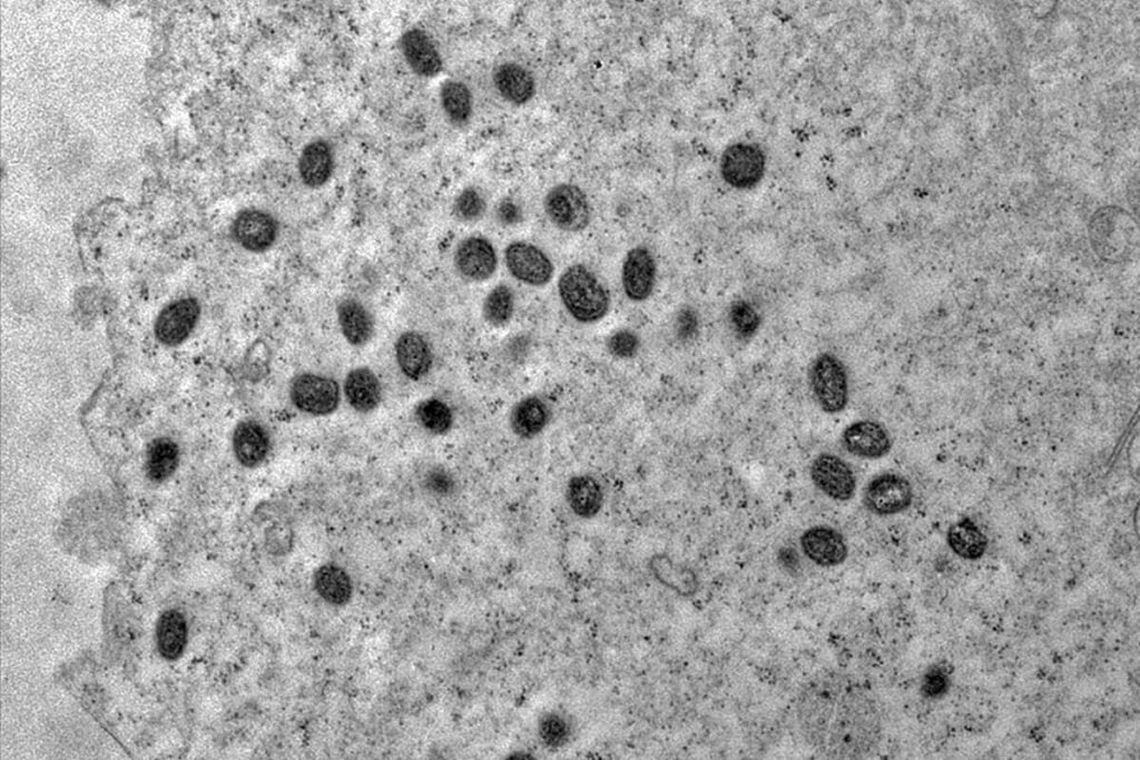 Imagem em preto e branco ddo vírus da monkeypox visto pelo microscópio - Metrópoles