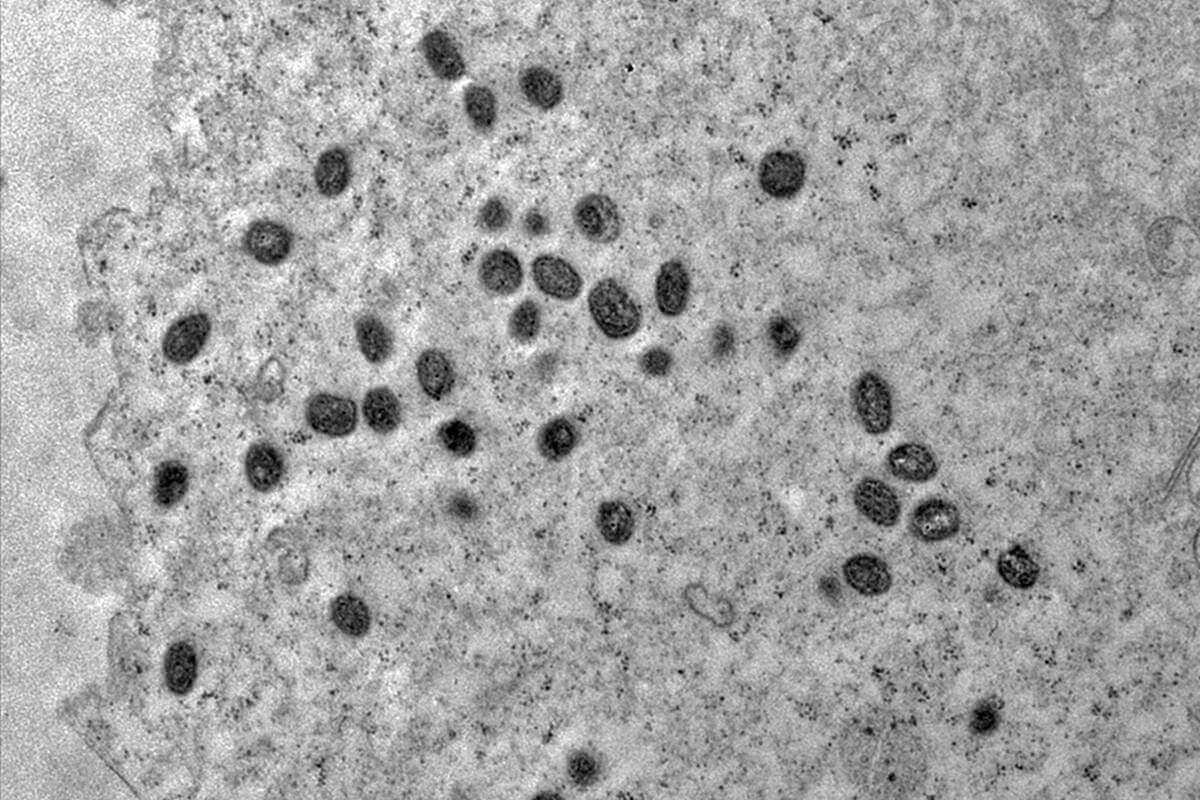 Imagem em preto e branco ddo vírus da monkeypox visto pelo microscópio - Metrópoles