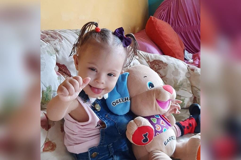 Ana Vitória, bebê com sindrome de Down - Metrópoles