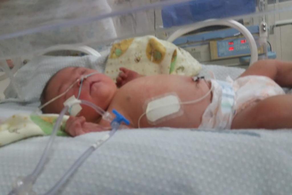 Ana Vitória, bebê com sindrome de Down - Metrópoles