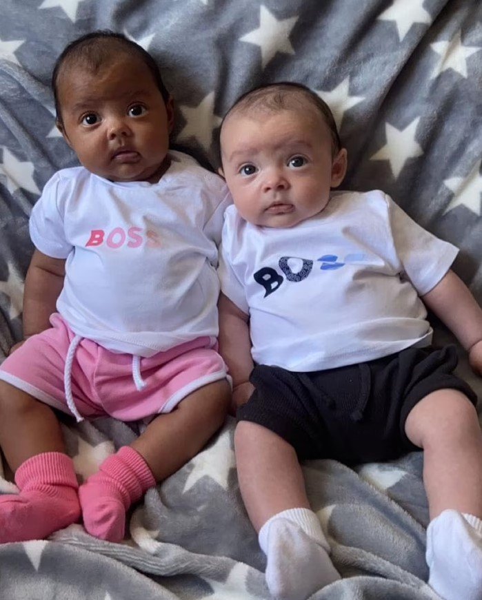 gemeos com tom de pele diferente