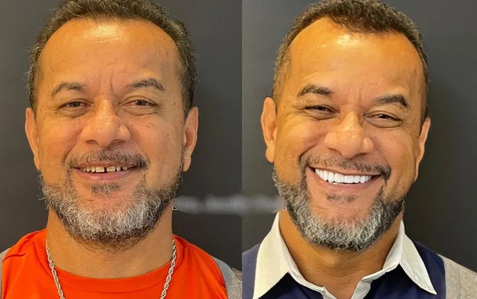 thumb-poster-3x2-218 goias homem morre apos facetas dentarias