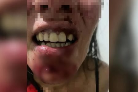 Mulher é agredida pelo ex em Goiás