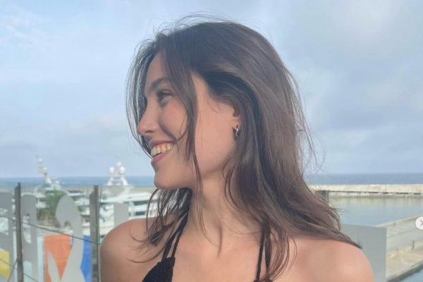 Sem grana, jovem só clareia dentes superiores e resultado é desastroso