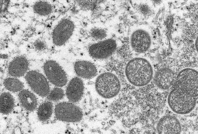 Imagem mostra vírus da varíola dos macacos (mpox) visto em microscópio - Metrópoles