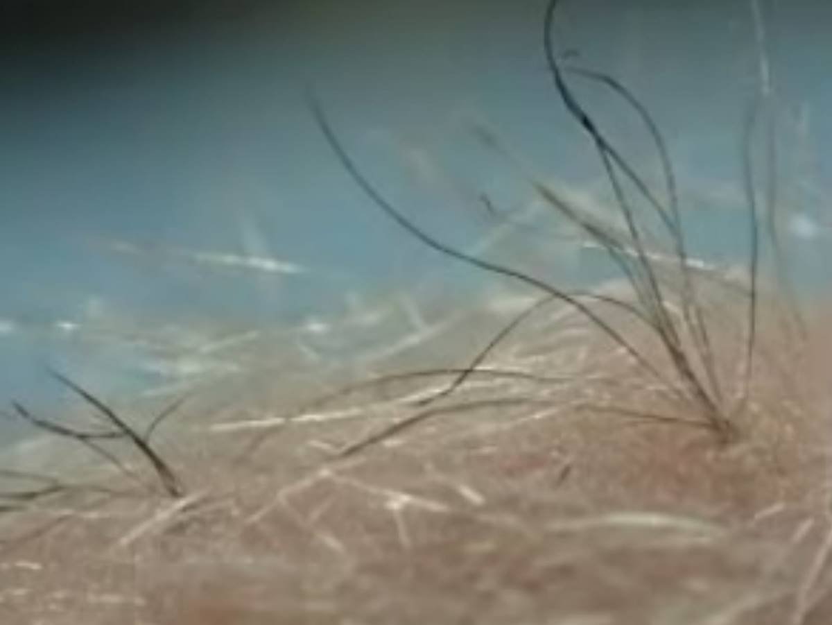 Calvão de cria': corte de cabelo para ficar calvo viraliza entre