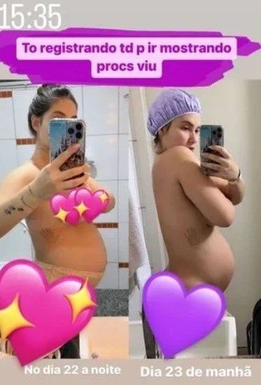 Virgínia Fonseca mostra o corpo e dá detalhes do pós-parto