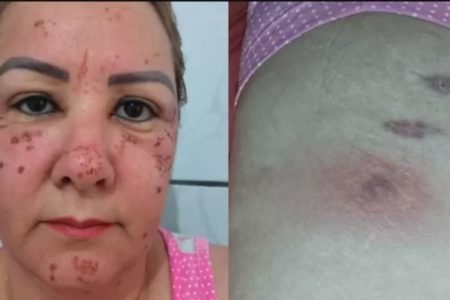colagem de fotos coloridas de mulher com rosto machucado