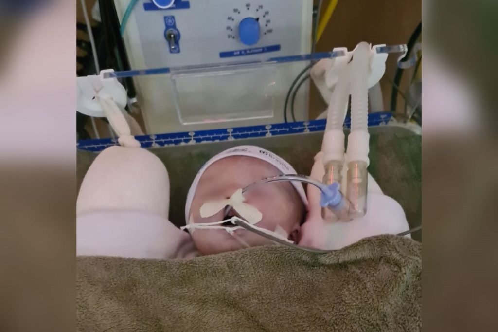 bebe morto durante parto (3)