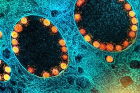 Imagem de microscópio da subvariante Ômicron BQ.1, do coronavírus - Metrópoles