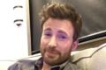 Foto colorida de Chris Evans com topete e usando camisa verde - Metrópoles