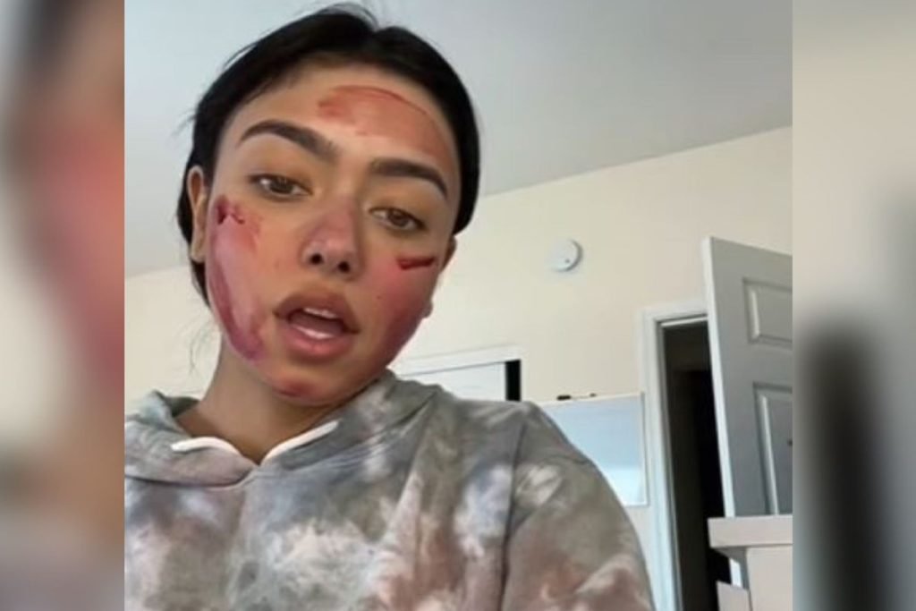Foto colorida de mulher com sangue no rosto. Trend do TikTok-Metrópoles