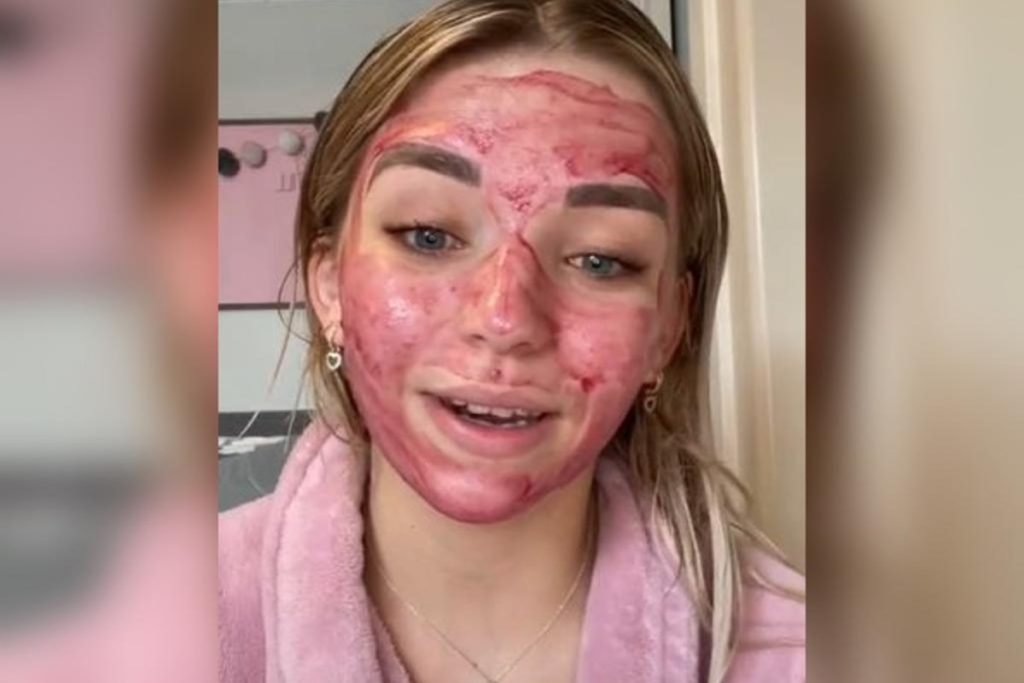 Foto colorida de mulher com sangue no rosto. Trend do TikTok-Metrópoles
