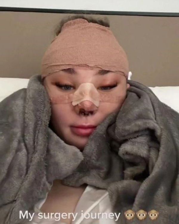 Foto colorida de uma mulher branca usando um cobertor cinza e o rosto com faixa