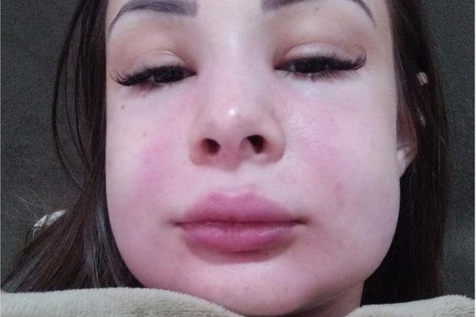 pamela em recuperação