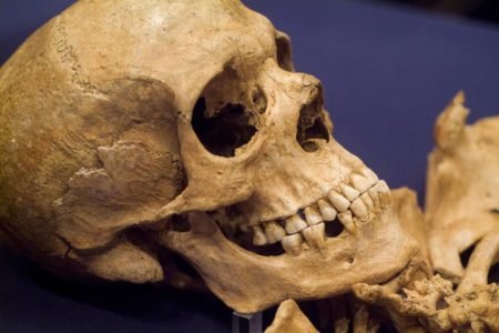 imagem colorida: crânio humano de perfil - Metrópoles