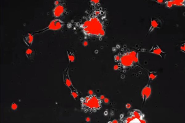Imagem em preto e vermelho mostra a evolução do coronavírus - Metrópoles